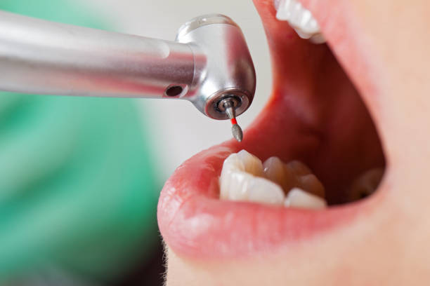 Best Walk-In Emergency Dental Services in Luckey, OH
